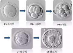 试管婴儿不能成功受精，该怎么办？