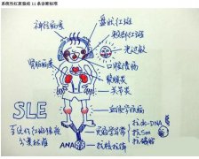 红斑狼疮美国三代试管可以排除吗？能够自己生育吗？