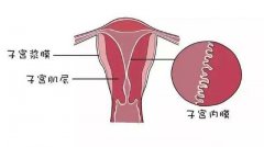 子宫内膜增生可以做试管婴儿吗？听听诺优笙国际医生怎么说