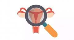多囊卵巢综合症适合做第几代试管婴儿？