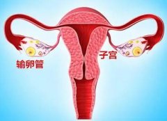 输卵管堵塞有积水能做试管婴儿助孕吗？输卵管积水的病因有哪些？