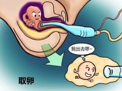 美国试管婴儿中的取卵与胚胎移植过程是怎样的？