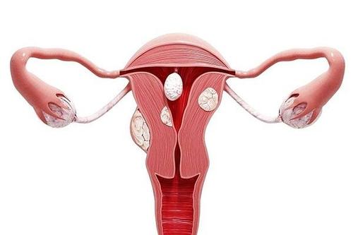  诺优笙国际：宫颈白斑影响美国试管婴儿成功吗？