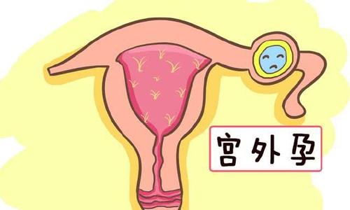  诺优笙国际：美国试管能避免宫外孕吗？如何做提高试管成功率？