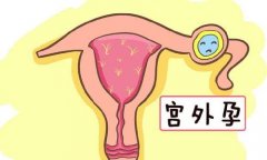 美国试管能避免宫外孕吗？如何做提高试管成功率？